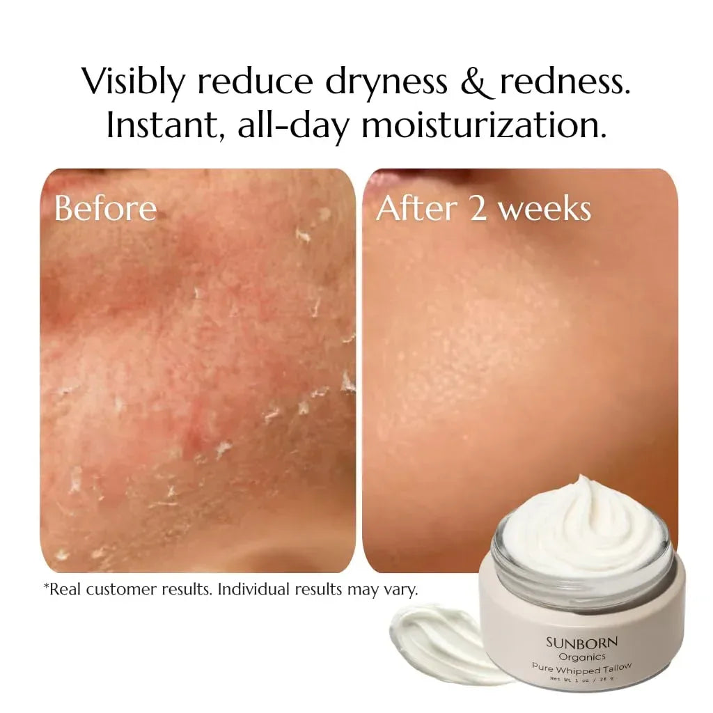 Pure Whipped Tallow Balm (Unscented) | 1 Ingredient | Handmade in USA | 100% Organic Grass-Fed Beef Tallow Face Moisturizer Lotion for Dry Skin, Baby, Eczema, Rosacea, Sensitive Skin, Fragrance-Free - Handmade Lifestyle Shop