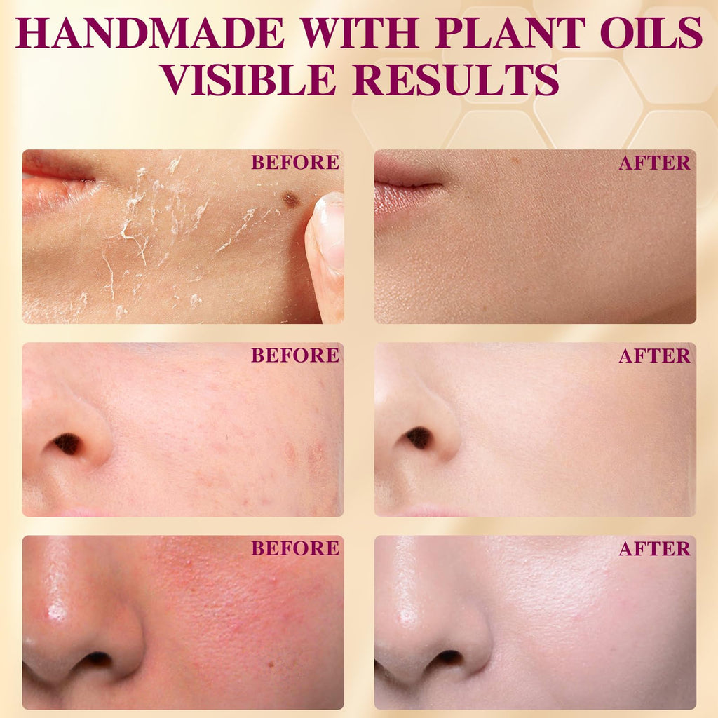 Beef Tallow Honey Balm, Grass-Fed Tallow Moisturizer for Face and Body, Deep Hydration Cream with White Tea Scent, Handmade Natural Skin Nourishment, 2.1 oz