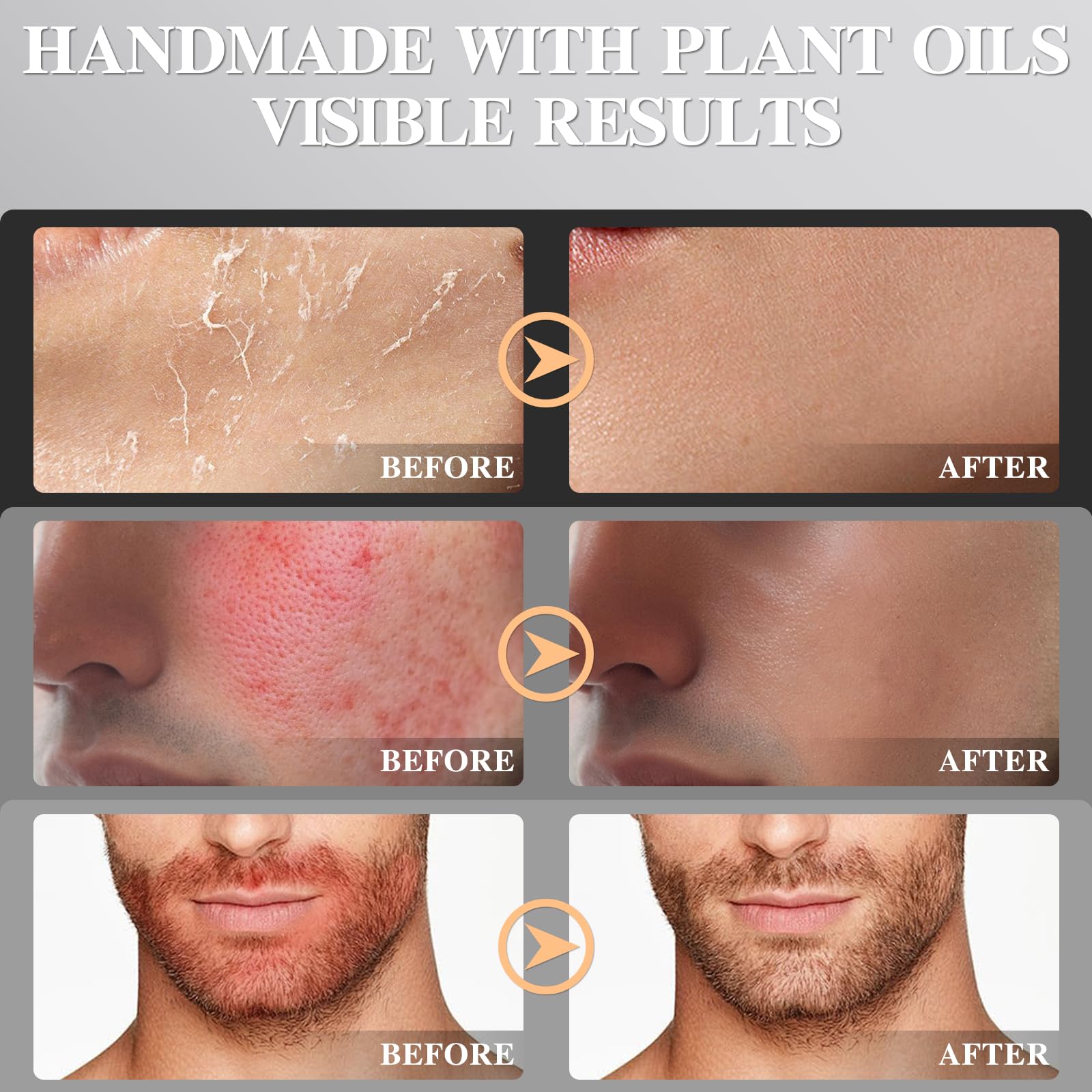 Beef Tallow Honey Balm, Grass-Fed Tallow Moisturizer for Face and Body, Deep Hydration Cream with White Tea Scent, Handmade Natural Skin Nourishment, 2.1 oz