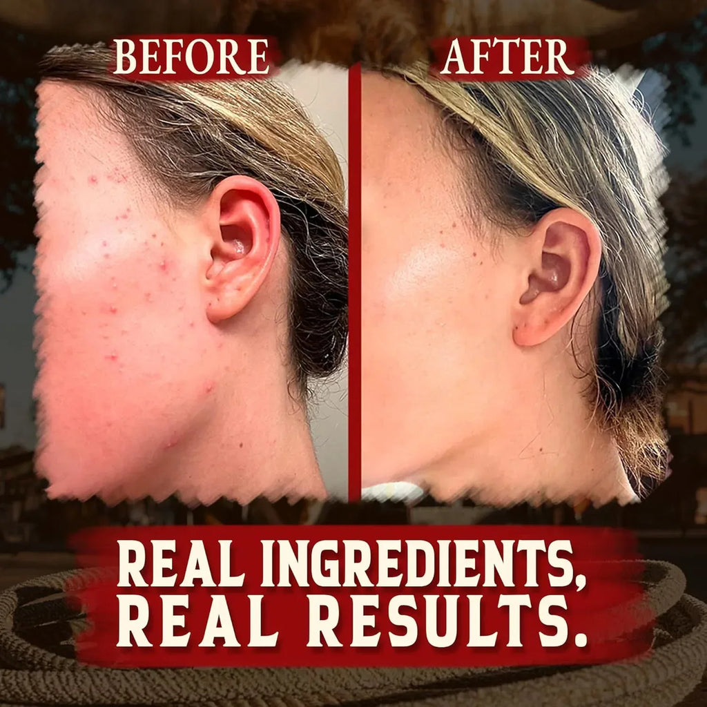 Organic Beef Tallow for Skin - 4 OZ (Unscented) — Grass Fed Beef Tallow for face + Body — US-Made Whipped Tallow and Honey Balm Moisturizer for Dry and Sensitive Skin, Eczema, Rosacea (No Additives) - Handmade Lifestyle Shop